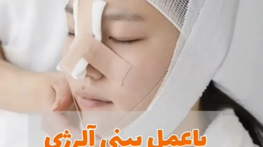از بین رفتن آلرژی با عمل بینی! دکتر یعقوب محبوبی اسکوئی