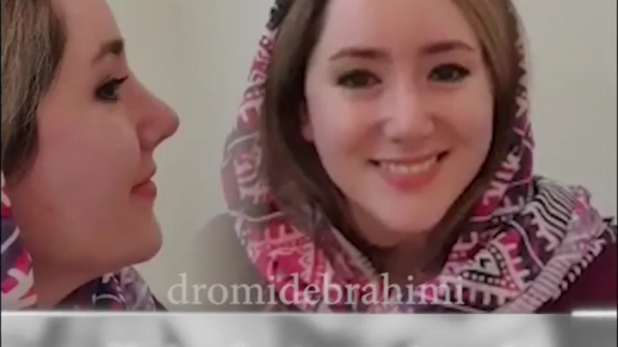 عمل زیبایی بینی استخوانی با مشکل تنفسی و انحراف تیغه میانی بینی دکتر امید ابراهیمی
