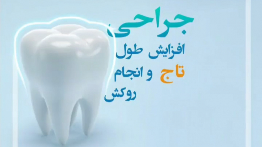 انیمیشن جراحی افزایش طول تاج و روکش دندان بیماری ترومبوسایتوز اسنشیال