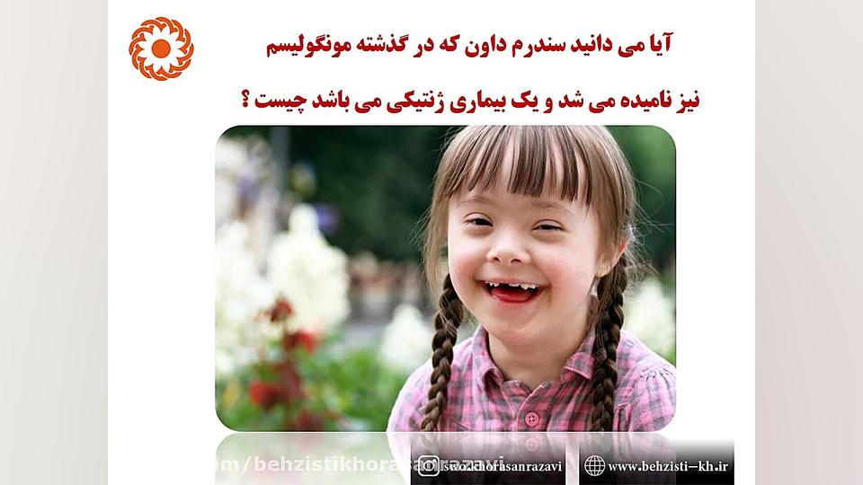 نماگراف سندروم داون هایفوتراپی