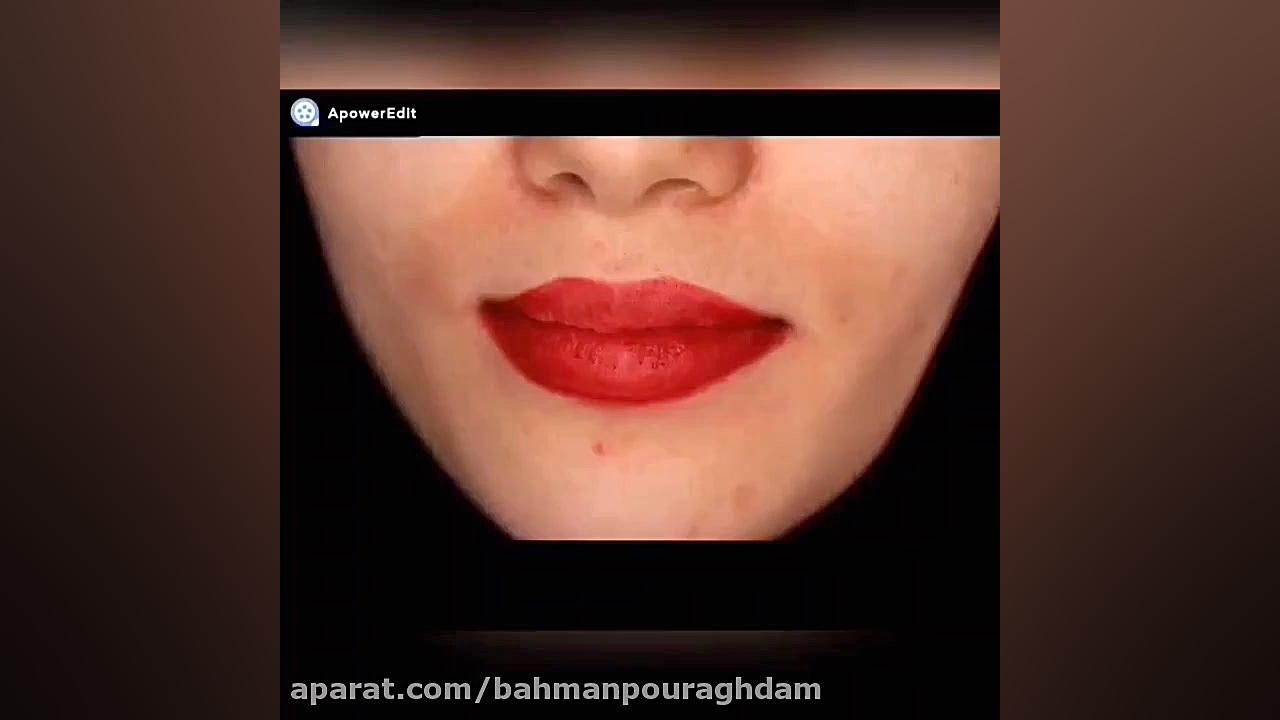 بهترین لمینت سرامیکی دندان (دکتر بهمن پوراقدم) 02122220000 دکتر بهمن پوراقدم 02122220000