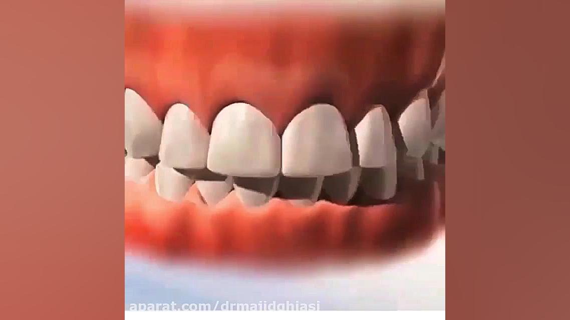 ارتودنسی دندان زیبایی دکترمجیدقیاسی