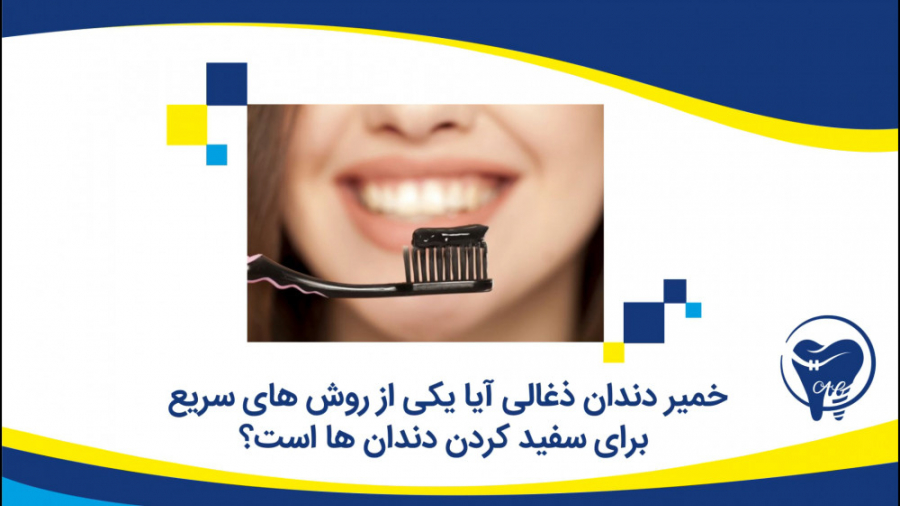 سفید کردن دندان با خمیر دندان ذغالی کلینیک دندانپزشکی دکتر عزیز گشاده رو