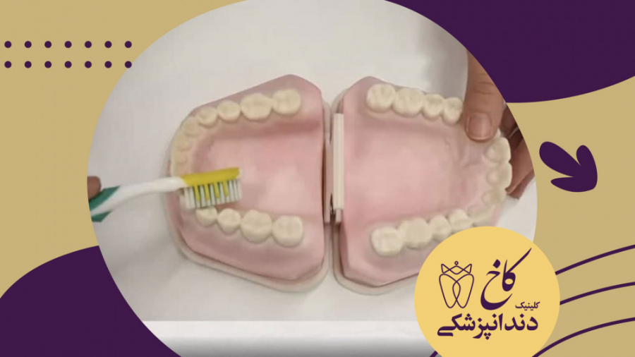 آموزش شیوه صحیح مسواک زدن کلینیک دندانپزشکی کاخ