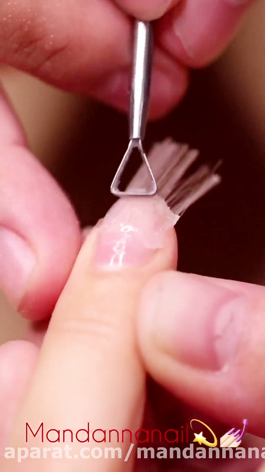 کاشت با فیبر و بیلدرژل