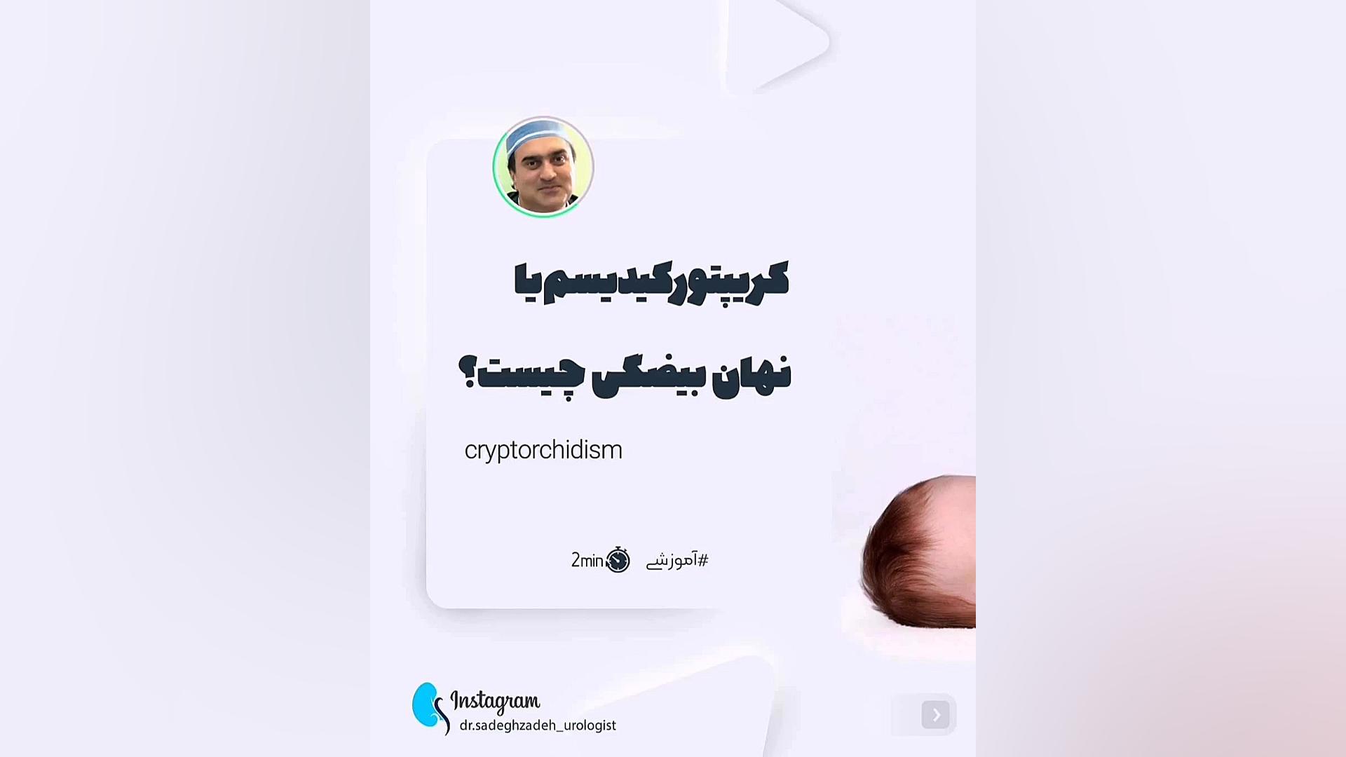 بیضه نزول نکرده دکتر سعید صادق زاده(جراح و متخصص کلیه و مجاری ادراری و تناسلی) ماستوسیتوز