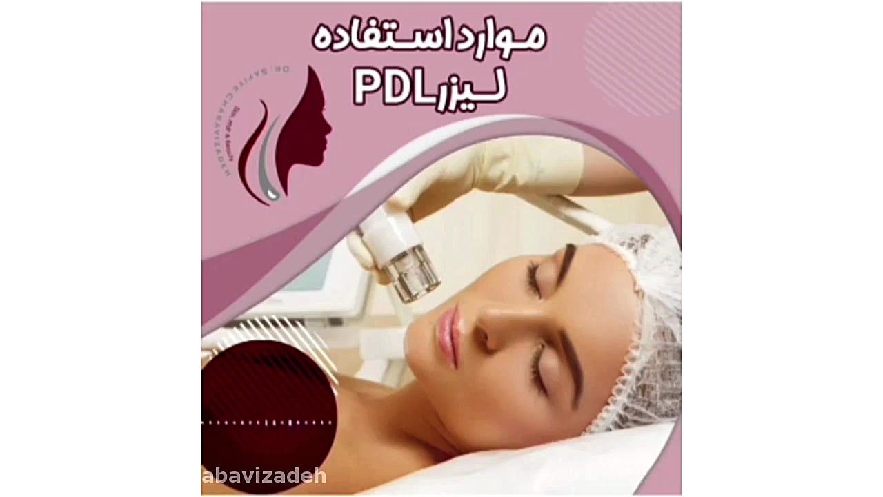 لیزر pdl و موارد استفاده از آن دکتر صفیه چعباوی زاده