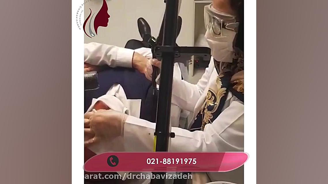 فیلم درمان ضایعات پوستی با لیزر (2) دکتر صفیه چعباوی زاده
