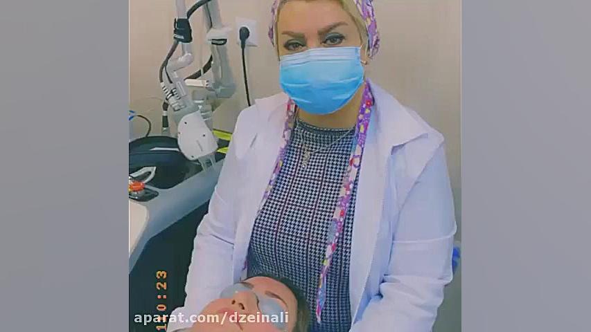 نتیجه تزریق چربی بعد از دوسال از تزریق دکتر فرحناز زینعلی - متخصص پوست، مو، زیبایی زنجان