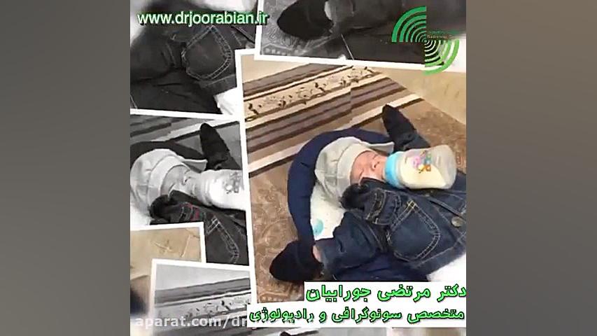 فیلم نوزاد هنگام سونوگرافی جراحی فک