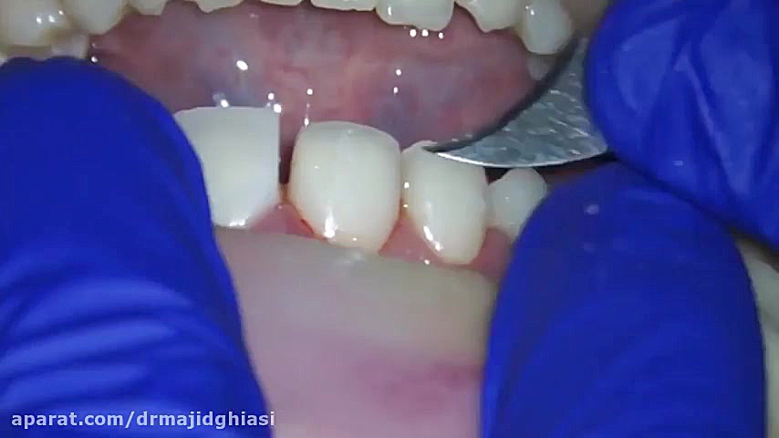 لبخند زیبا ؛ هدیه ما به شما دکترمجیدقیاسی