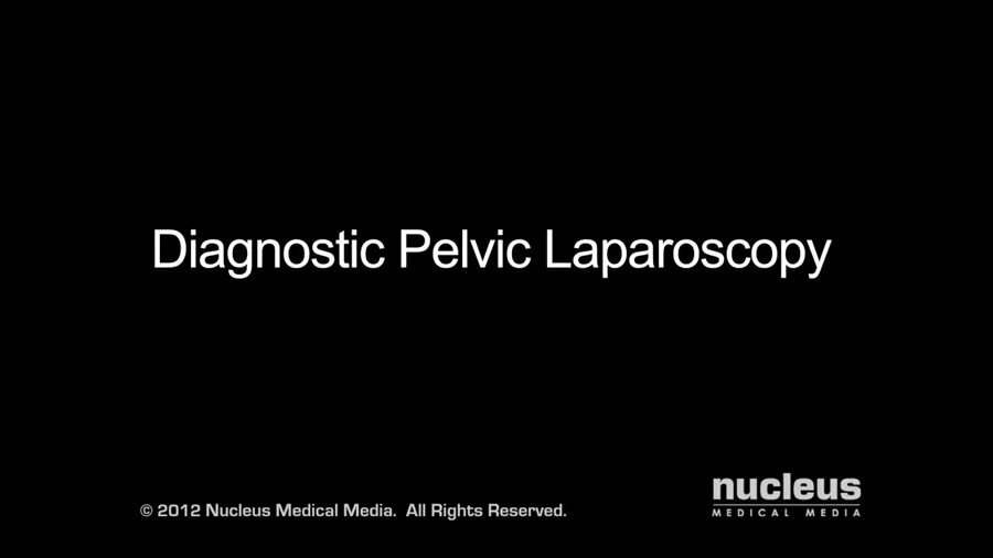 Diagnostic Pelvic Laparoscopy