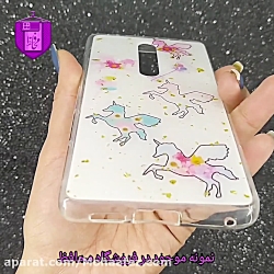 قاب فانتزی شیائومی کد XM281F