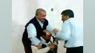 کشیدن دندان بدون بی حسی خیلی خنده داره بررسی لک صورت