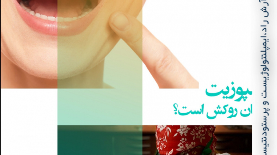 تفاوت کامپوزیت و روکش دندان - دکتر غزال آرش راد متخصص پروتزو ایمپلنت دندان اونپاترو