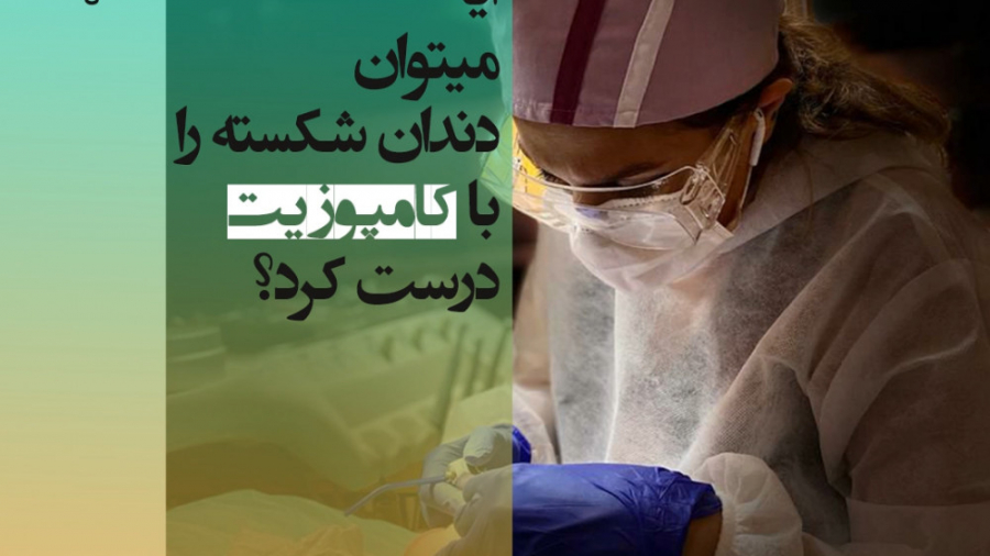 آیا میتوان دندان شکسته را کامپوزیت کرد؟ - دکتر غزال آرش راد متخصص پروتز دندان پیلینگ