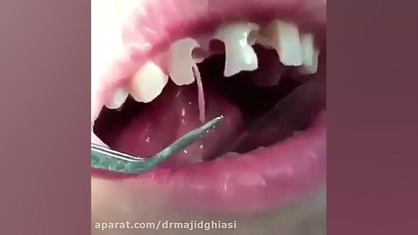 پالپ دندان دکترمجیدقیاسی