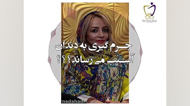 ‌آیا جرم گیری به دندان آسیب می رساند؟؟؟ دکتر ندا هادی-دندانپزشک زیبایی