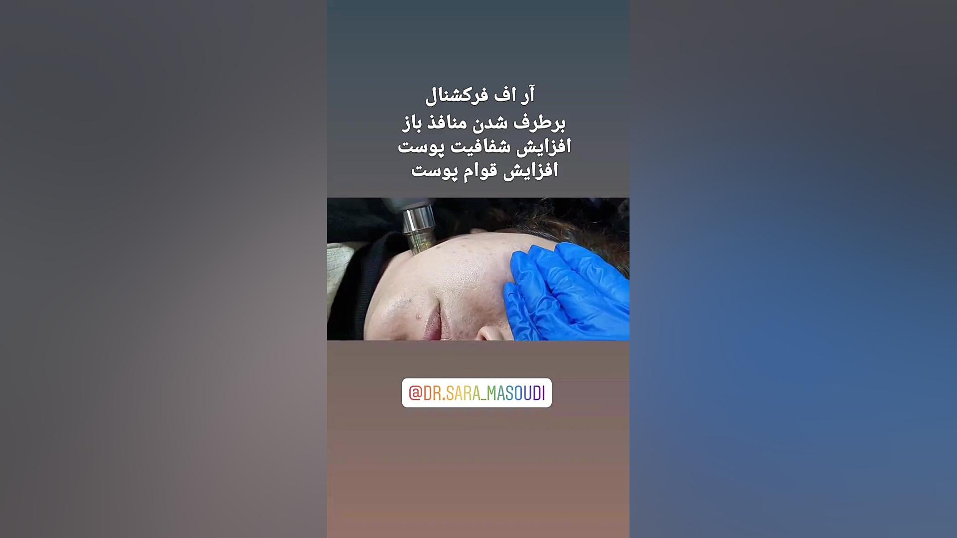 آر اف فرکشنال کاشان پزشکی درد مداوم