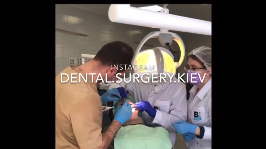 جراحى كيست فك بالا با حفظ دندان. مهدى سطوتى