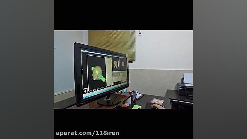 کلینیک رادیوتراپی و انکولوژی در رشت لیپوساکشن