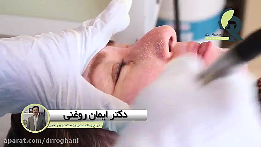 فیلم پاکسازی پوست صورت با میکرودرم دکتر ایمان روغنی جراح و متخصص پوست و مو