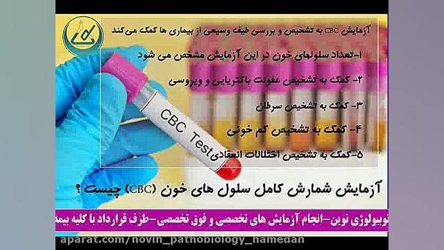 آزمایشگاه پاتوبیولوژی نوین آزمایشگاه پاتوبیولوژی نوین همدان
