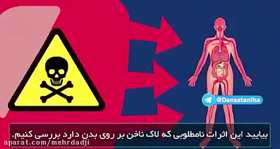 لاک با ناخن چه می کند حتما نگاه کنید