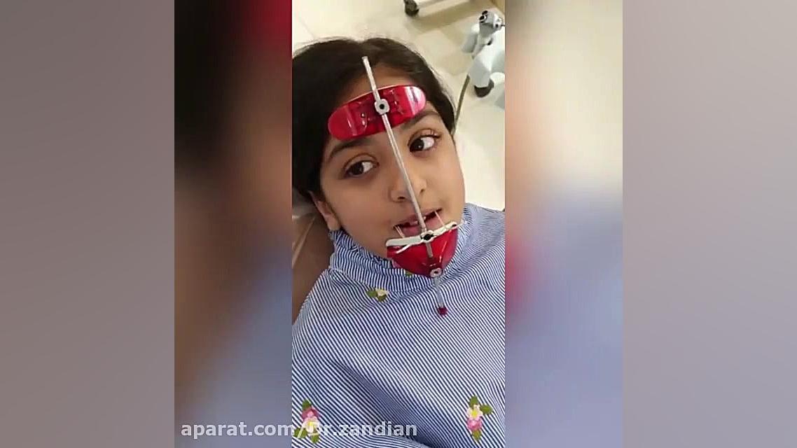 فیس ماسک ارتودنسی دکتر دانا زندیان