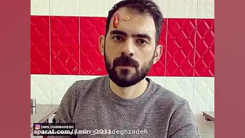 ساندویچی بعد کرونا/ هومن ایران منش لیزر فرکشنال