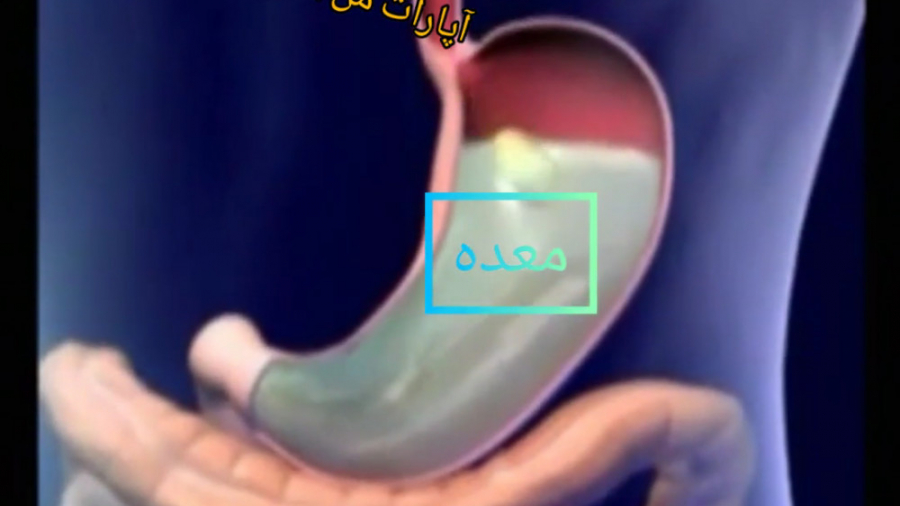 آموزش علوم آموزش دستگاه گوارش و هضم غذا پریودنتیکس