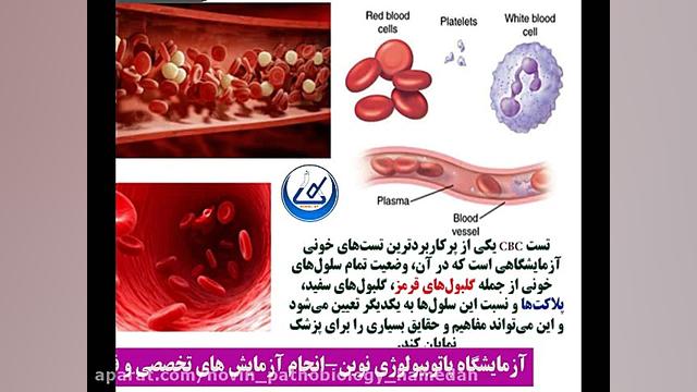اهمیت آزمایش خون سی بی سی در تشخیص بیماری ها آزمایشگاه پاتوبیولوژی نوین همدان