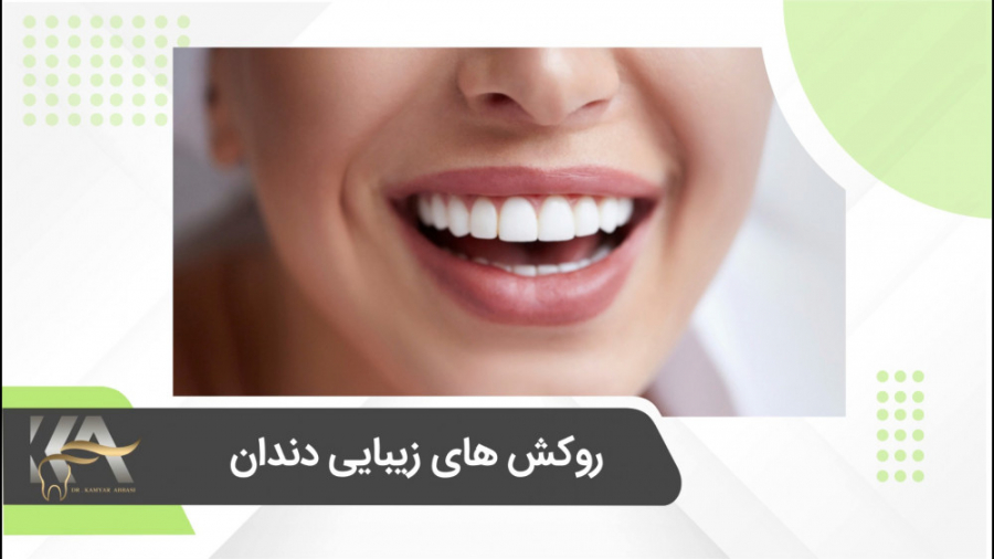 روکش های زیبایی دندان دکتر کامیار عباسی متخصص ایمپلنت و زیبایی مزوتراپی