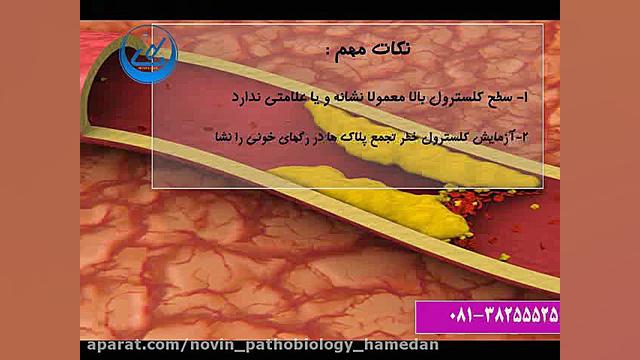 آزمایش کلسترول (Cholesterol) بخشی از آزمایش پانل چربی خون است آزمایشگاه پاتوبیولوژی نوین همدان