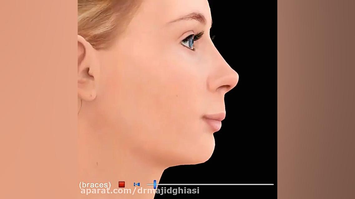 ارتودنسی دندان زیبایی دکترمجیدقیاسی