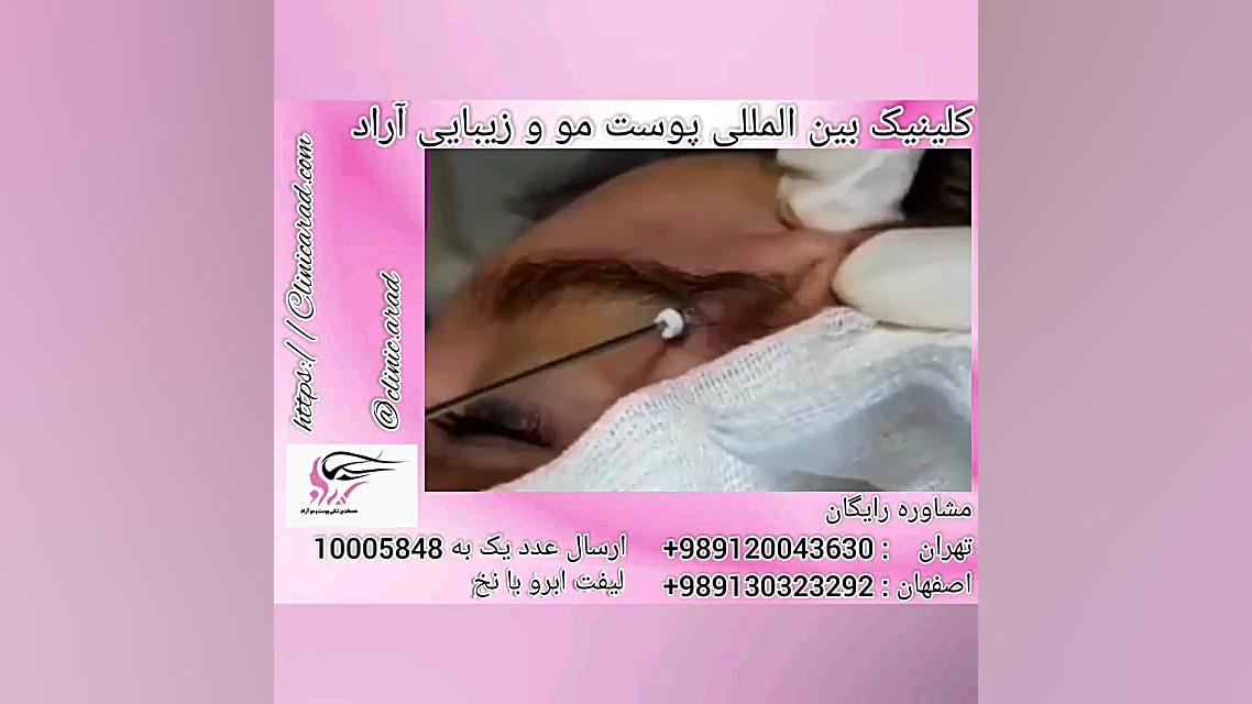 لیفت ابرو با نخ وزارتان