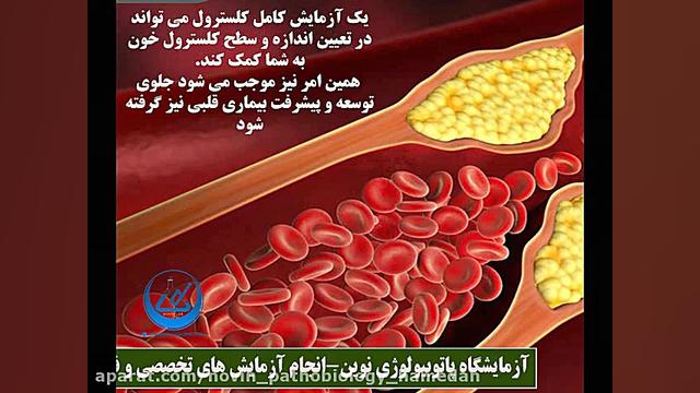 آزمایش کلسترول (Cholesterol) آزمایشگاه پاتوبیولوژی نوین همدان