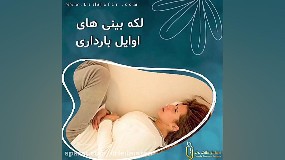 توضیحات دکتر لیلا جعفری در مورد لکه بینی های اول بارداری دکتر لیلا جعفری