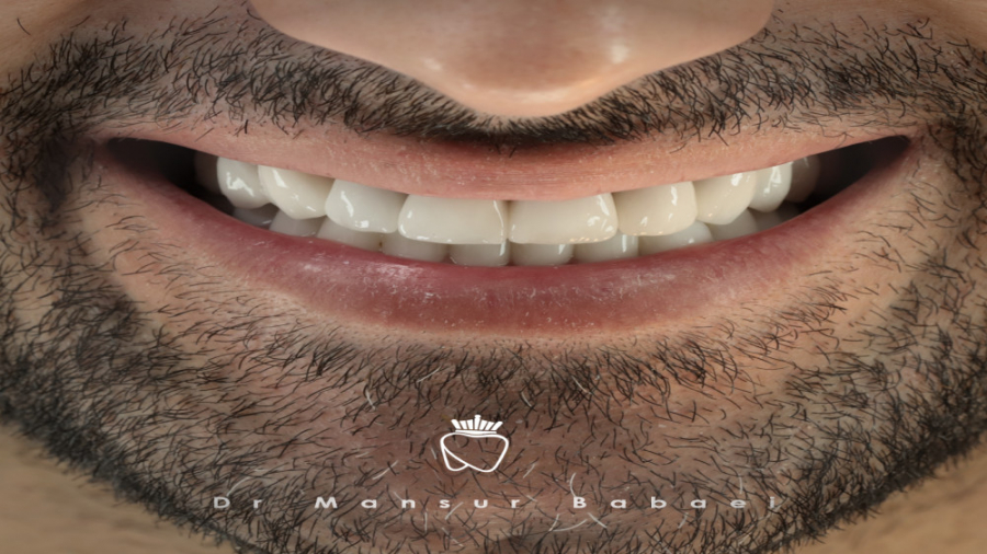 یه کار درمانی پیچیده و زمانبر برای مراجعه کننده خوشتیپ دکتر منصور بابایی