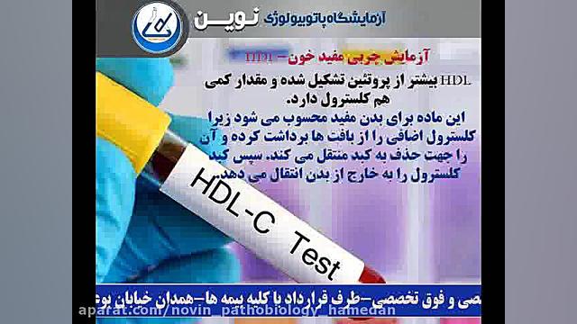 آزمایش کلسترول HDL - کلسترول خوب آزمایشگاه پاتوبیولوژی نوین همدان