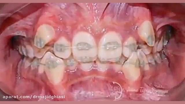 ارتودنسی دندان زیبایی دکترمجیدقیاسی