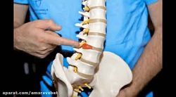 نحوه برخورد با آسیب ستون فقرات...