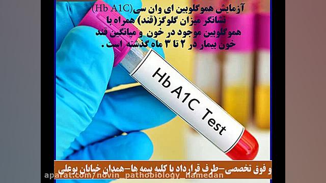 آزمایش هموگلوبین ای وان سی (HbA1C) چیست؟ آزمایشگاه پاتوبیولوژی نوین همدان