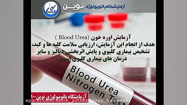 آزمایش اوره خون (Blood Urea ) آزمایشگاه پاتوبیولوژی نوین همدان