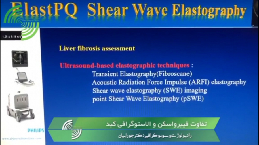 فیبرواسکن کبد چرب را دقیق نشان می دهد و یا الاستوگرافی ؟ پوسیدگی دندان
