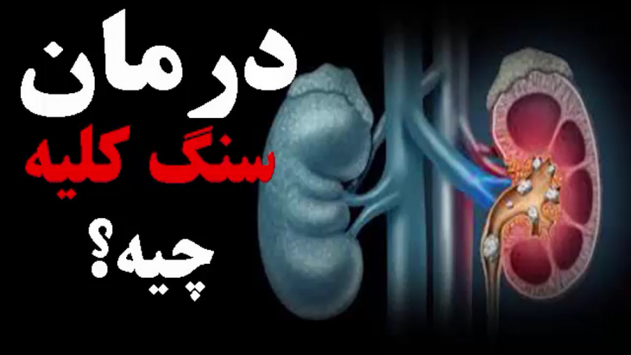 درمان سنگ کلیه*دکترمیرشکاری* کلینیک پوست