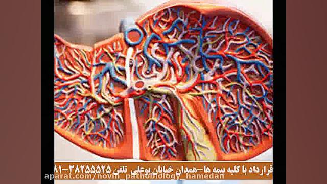 آزمایش SGOT چیست؟ آزمایشگاه پاتوبیولوژی نوین همدان