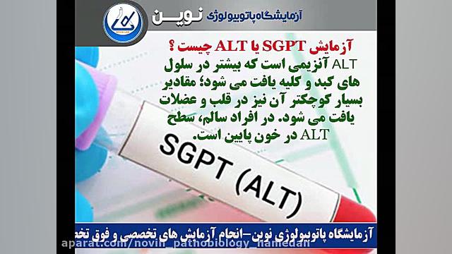 آزمايش SGPT یا ALT چیست ؟ آزمایشگاه پاتوبیولوژی نوین همدان