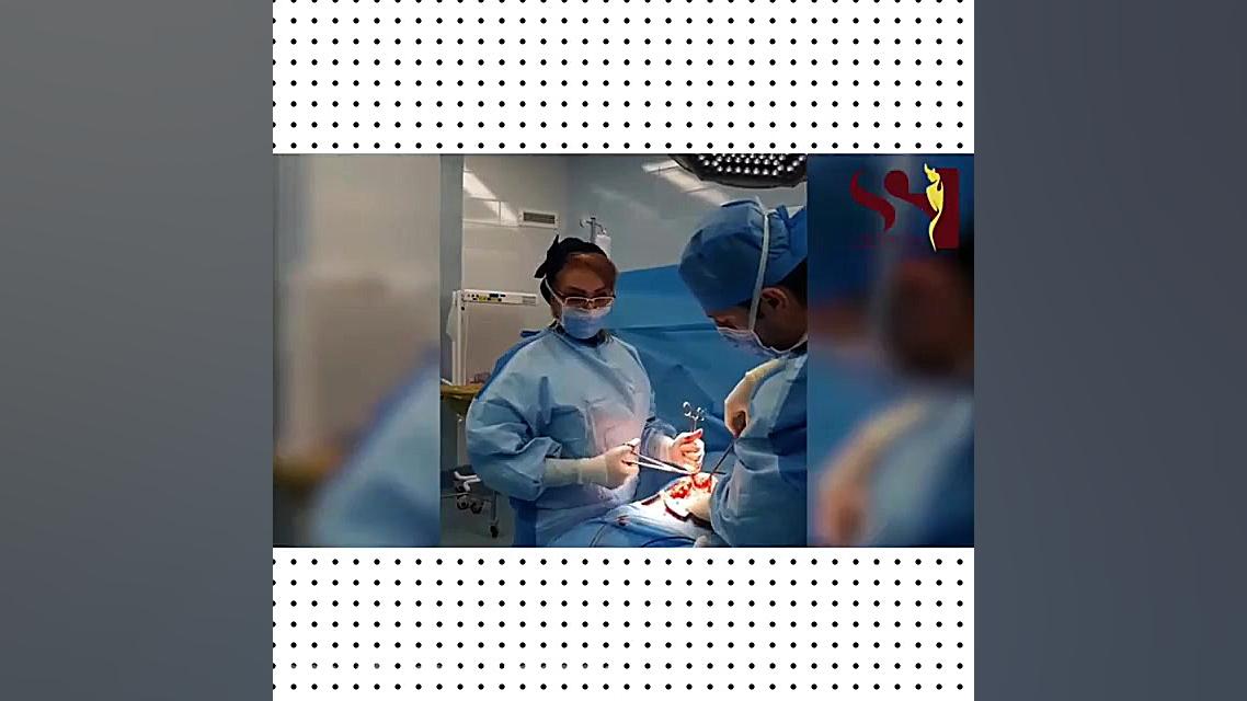 فیلم واقعی خارج کردن رحم خانم ۳۸ ساله همزمان با ابدومینوپلاستی در اتاق عمل دکتر شیرین شمس جراح و متخصص زنان و زایمان