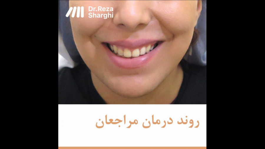 روند درمان ارتودنسی دکتر رضا شرقی